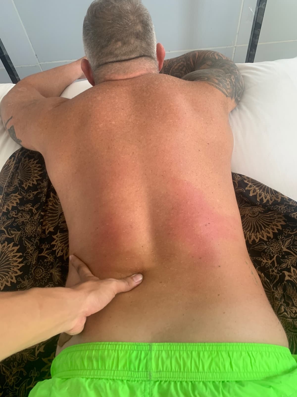 Raka ajie therapeutic